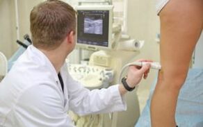 Metode za liječenje varikoznih vena na nogama kod žena